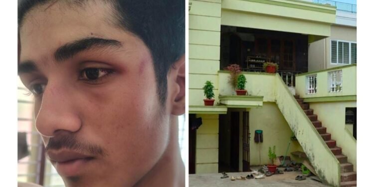 ಪಿಜಿ ಚೆನ್ನಾಗಿಲ್ಲ ಎಂದಿದ್ದಕ್ಕೆ ವಿದ್ಯಾರ್ಥಿ ಮೇಲೆ ಹಲ್ಲೆ ನಡೆಸಿದ ಪಿಜಿ ಓನರ್