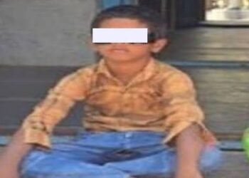 ಶಿಕ್ಷಕಿಯ ಕೋಪಕ್ಕೆ ಬಾಲಕನ ಬಲಗಣ್ಣಿನ ದೃಷ್ಟಿಯೇ ಹೋಯ್ತು