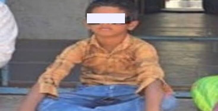 ಶಿಕ್ಷಕಿಯ ಕೋಪಕ್ಕೆ ಬಾಲಕನ ಬಲಗಣ್ಣಿನ ದೃಷ್ಟಿಯೇ ಹೋಯ್ತು